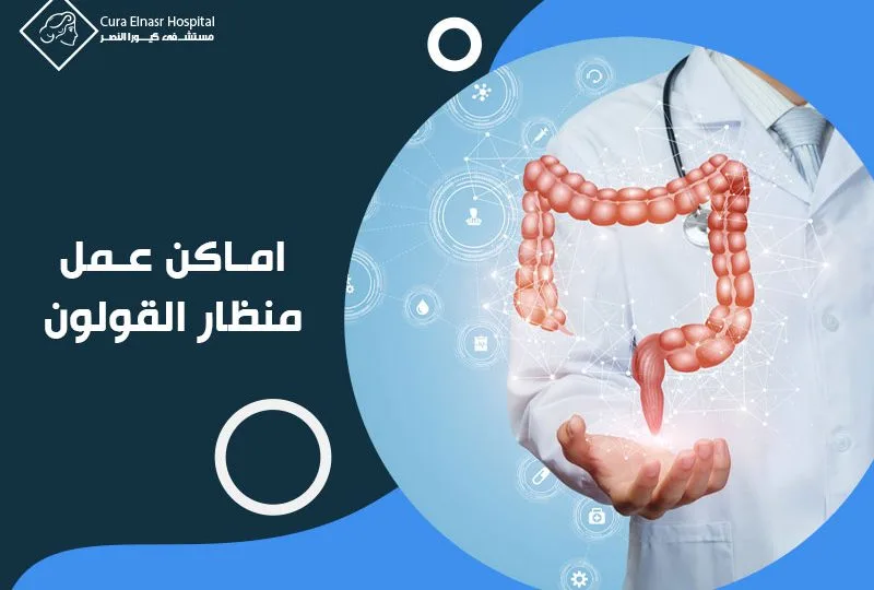اماكن عمل منظار القولون