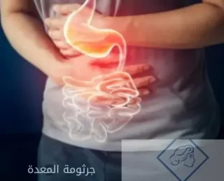 أسباب الإصابة بجرثومة المعدة