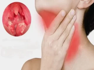 التهابات الحنجرة