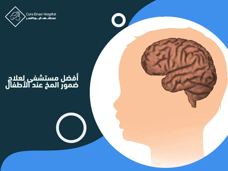 أفضل-مستشفى-لعلاج-ضمور-المخ-عند-الأطفال1.webp